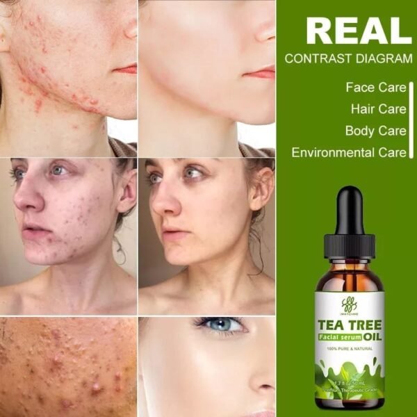 Tree Oil Facial Serum 10ml