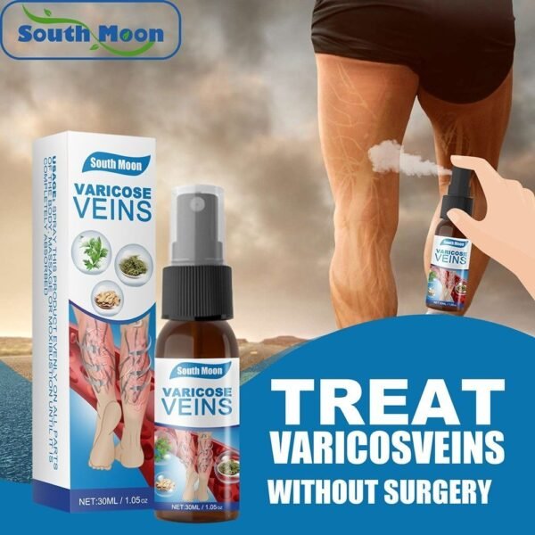 Varicose Veins Spider Legs Treatment (30ml)