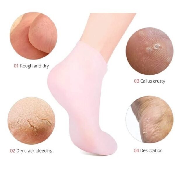 New Silicone Moisturizing Socks